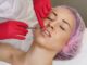 Botox boom di punturine spiana rughe in Italia