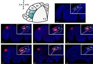 Le aree visive superiori del cervello influiscono sulla percezione della realta